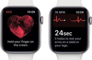 do-dien-tam-do-ecg-apple-watch